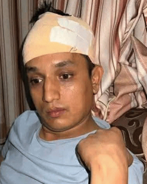 रास्वपा नेता भण्डारीमाथि आक्रमण