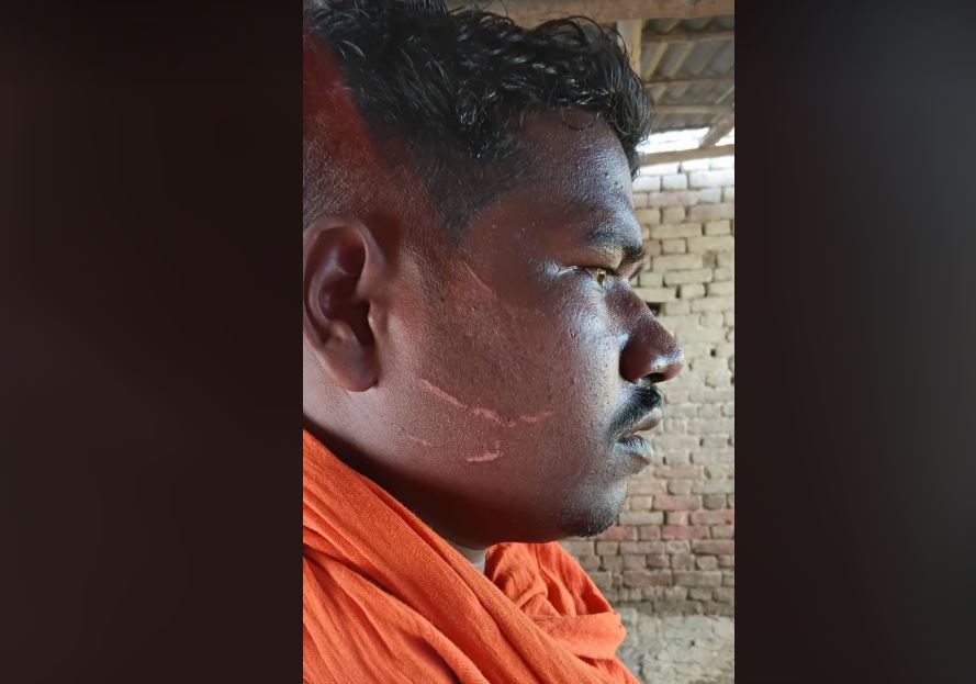 बीओपी नजिकै माछा फर्मका कामदारमाथि छुरा प्रहार, प्रहरीमाथि घटना मिलाउन दबाब दिएको आरोप