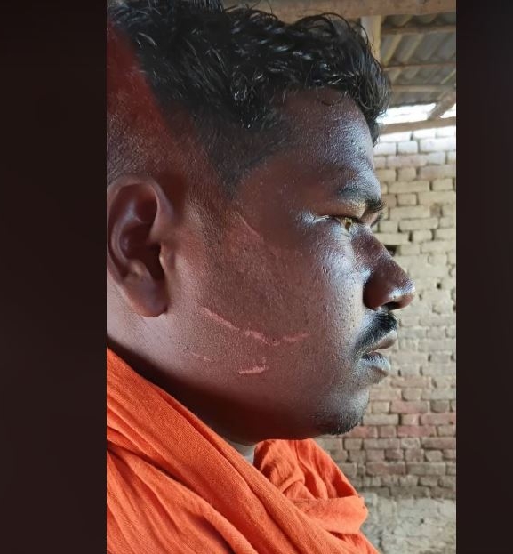 बीओपी नजिकै माछा फर्मका कामदारमाथि छुरा प्रहार, प्रहरीमाथि घटना मिलाउन दबाब दिएको आरोप