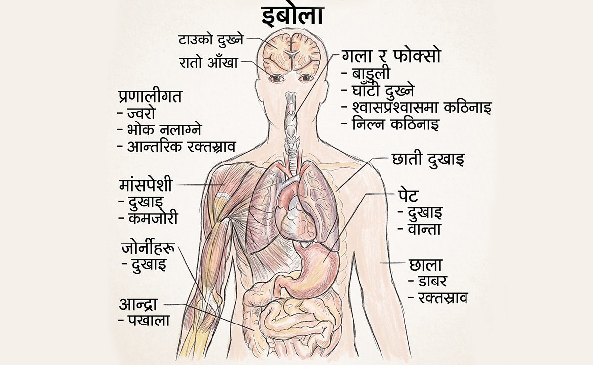 घातक इबोला भाइरस : उच्च सर्तकता