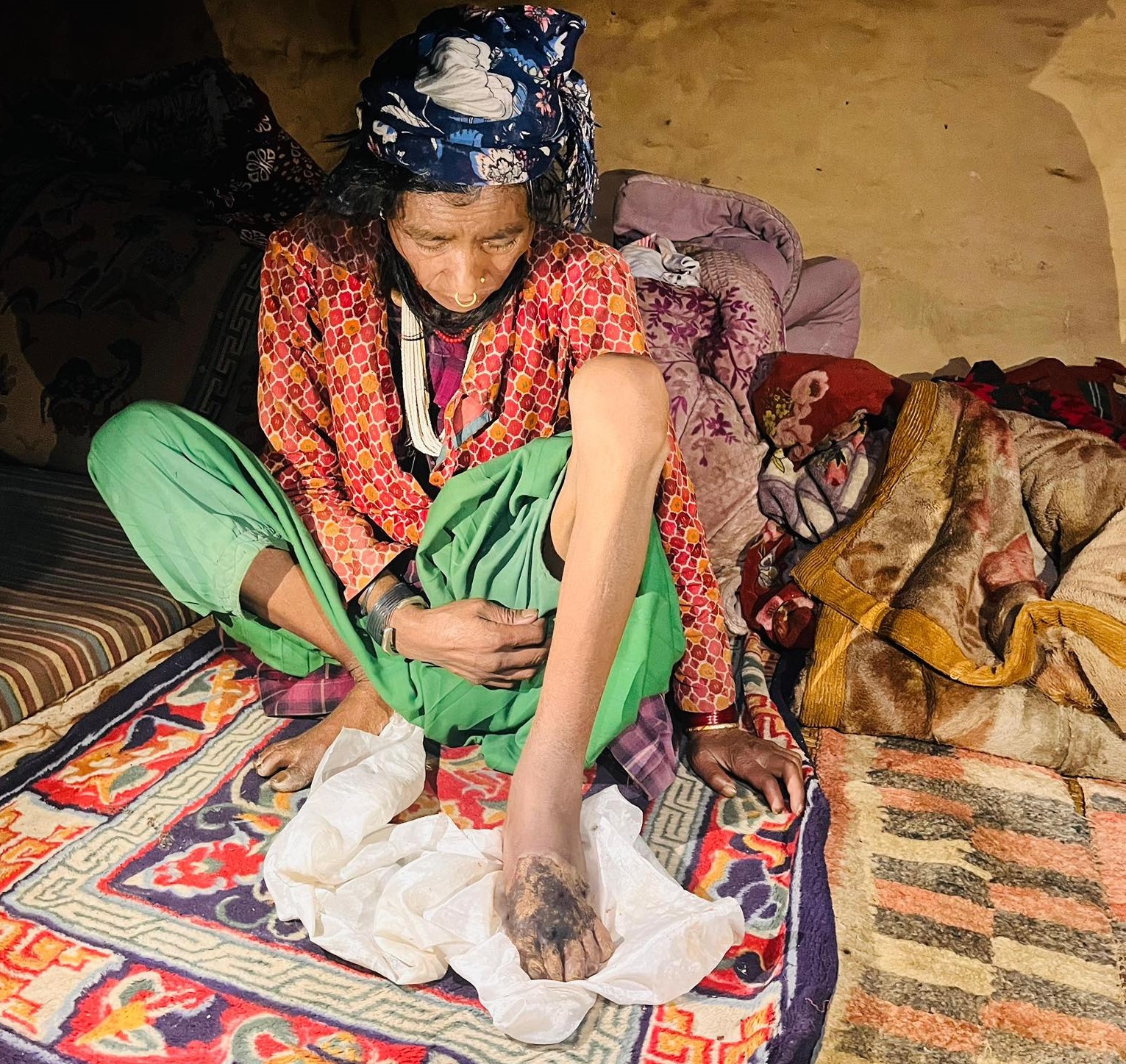 गाउँपालिका र स्थानीयको सहयोगमा महिलाको उद्धार, उपचारका लागि पठाइयो काठमाडौं