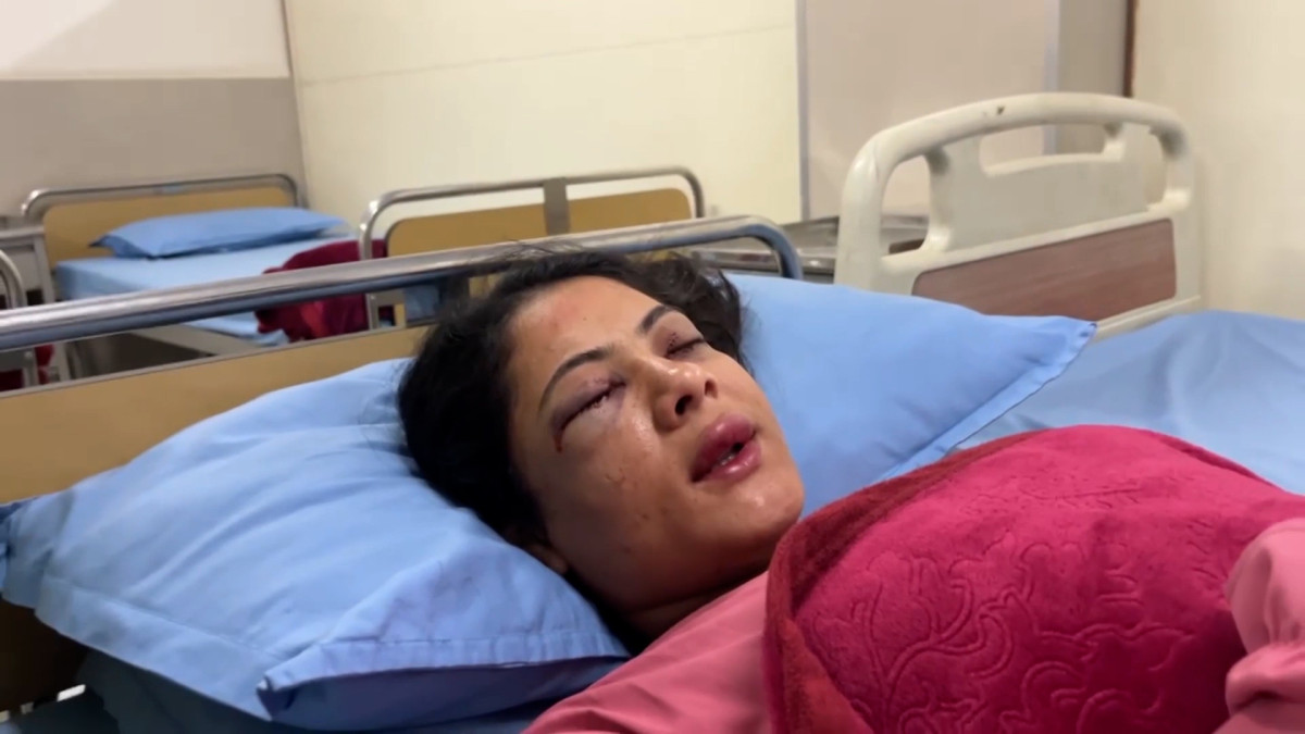शिक्षक आन्दोलनमा घाइते पत्रकार कार्की भन्छिन्- 'दाहिने आँखा खोल्नै मिल्दैन'